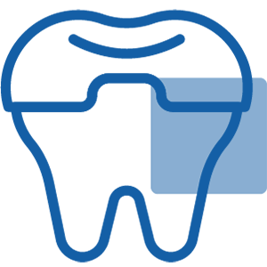 Transparante aligners